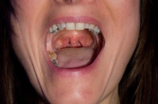 La tres sentimentale soiree d'ouverture du FNC (MTL)