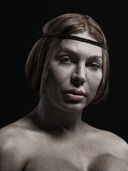 À quoi ressemble le corps après plusieurs opérations de chirurgie plastique? Le photographe Phillip Toledano nous le montre.